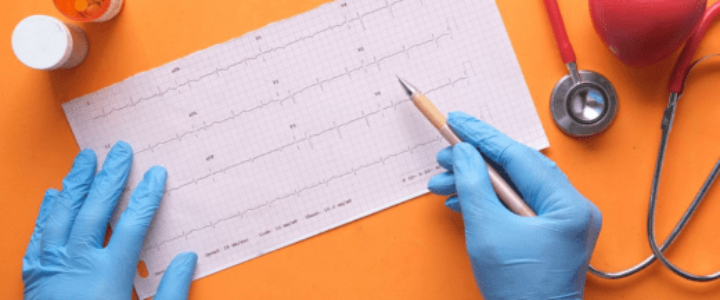 Exploring the Advantages and Disadvantages of Electrocardiogram (ECG)