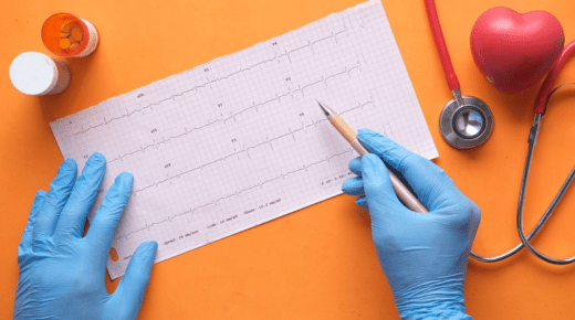 Exploring the Advantages and Disadvantages of Electrocardiogram (ECG)