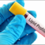 Lipid Profile Test