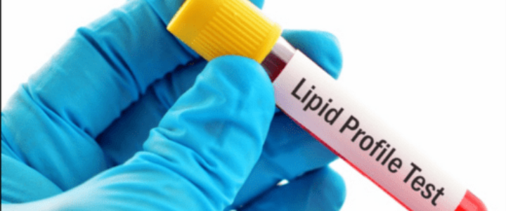 Lipid Profile Test