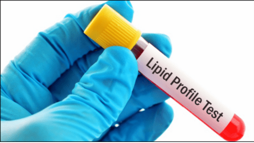 Lipid Profile Test