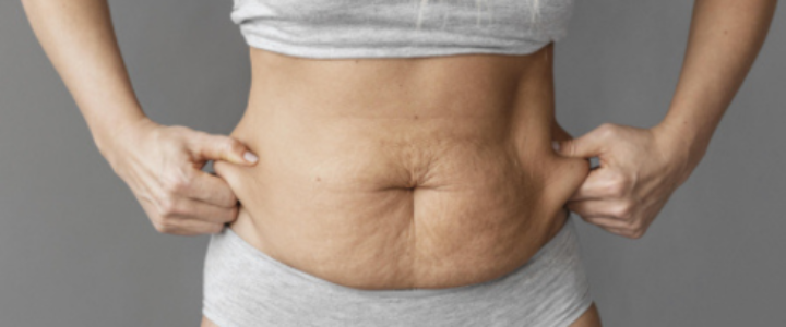 tummy tuck surgery in bangalore